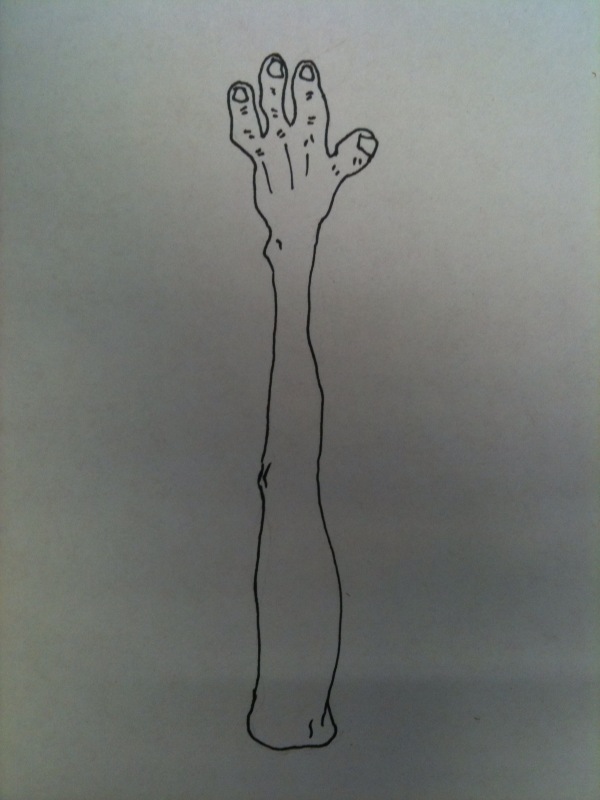 arm